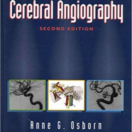 Diagnostic Cerebral Angiography