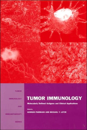 Tumor Immunology: Molecularly Defined Antigens and Clinical Applications