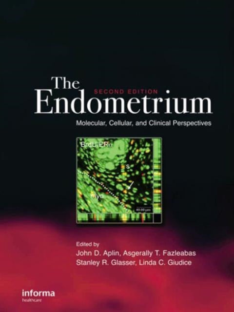 The Endometrium: Molecular, Cellular and Clinical Perspectives, Second Edition