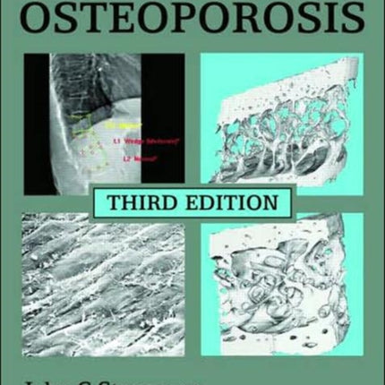 An Atlas of Osteoporosis