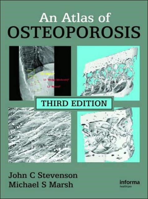 An Atlas of Osteoporosis