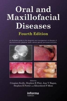 Oral and Maxillofacial Diseases