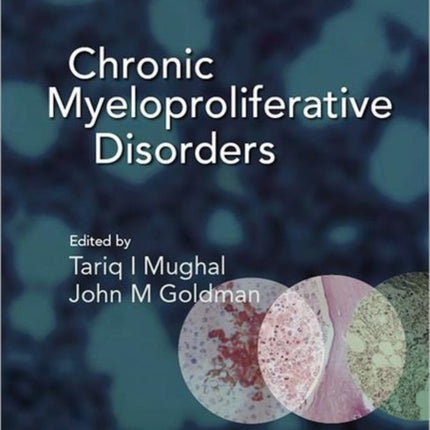 Chronic Myeloproliferative Disorders