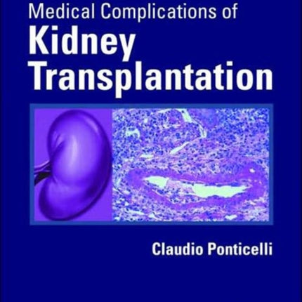 Medical Complications of Kidney Transplantation