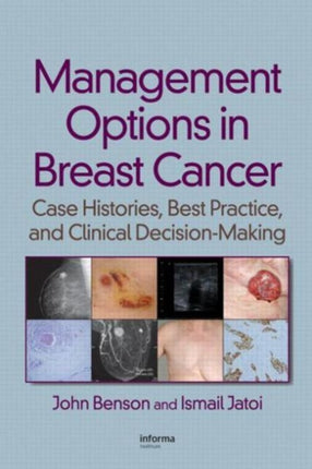 Management Options in Breast Cancer: Case Histories, Best Practice, and Clinical Decision-Making