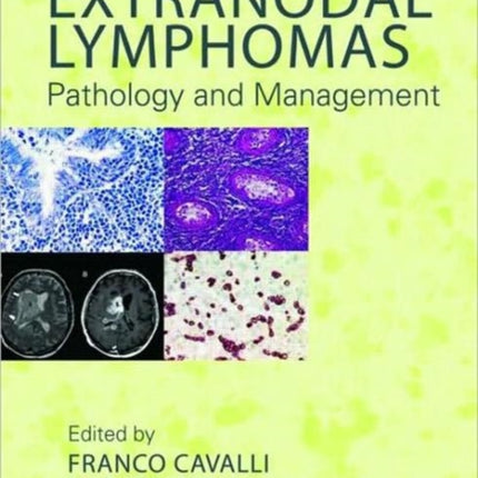 Extranodal Lymphomas: Pathology and Management