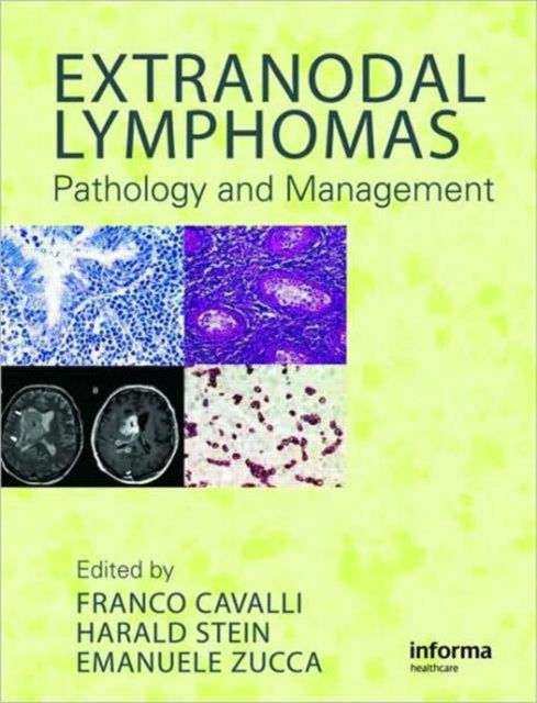 Extranodal Lymphomas: Pathology and Management