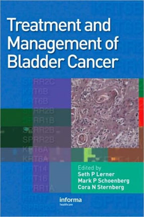 Treatment and Management of Bladder Cancer