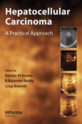 Hepatocellular Carcinoma: A Practical Approach