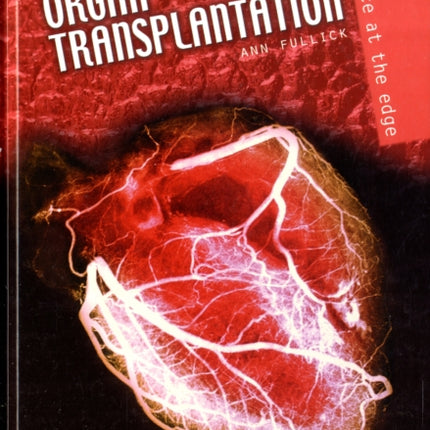 Organ Transplantation