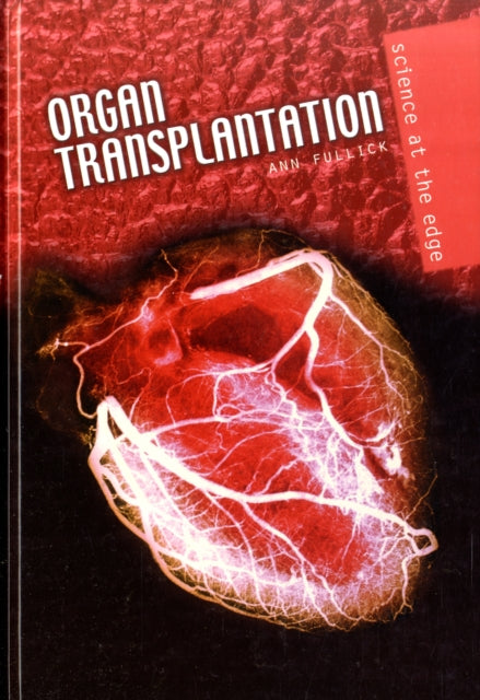 Organ Transplantation