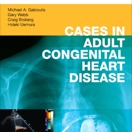 Cases in Adult Congenital Heart Disease - Expert Consult: Online and Print: Atlas