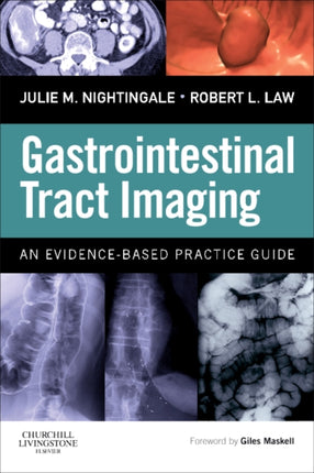 Gastrointestinal Tract Imaging An EvidenceBased Practice Guide Author Julie Nightingale published on November 2009