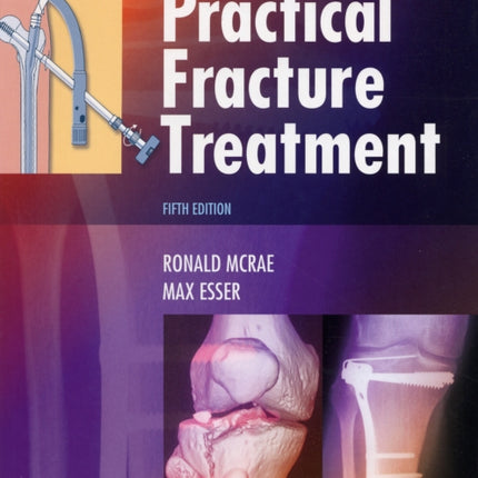 Practical Fracture Treatment