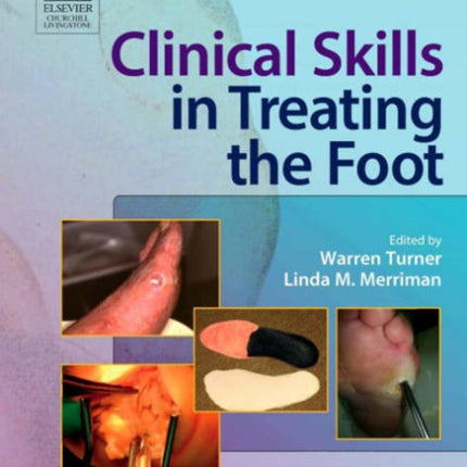 Clinical Skills in Treating the Foot