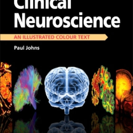 Clinical Neuroscience: An Illustrated Colour Text