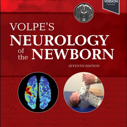 Volpes Neurology of the Newborn