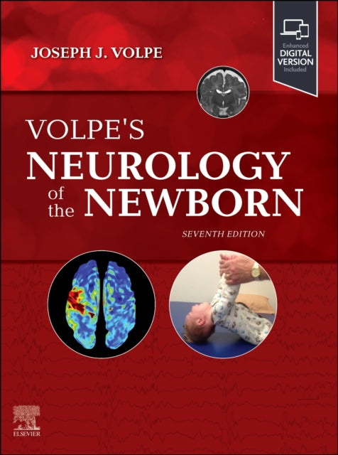 Volpes Neurology of the Newborn