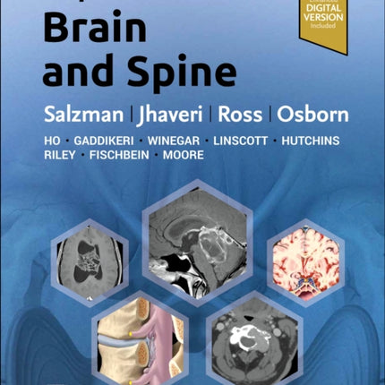 ExpertDDx: Brain and Spine