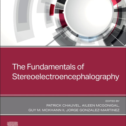 The Fundamentals of Stereoelectroencephalography