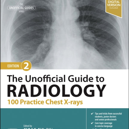 The Unofficial Guide to Radiology: 100 Practice Chest X-rays