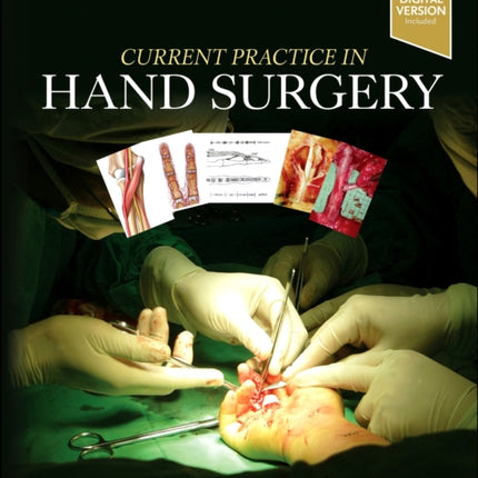 Current Practice in Hand Surgery