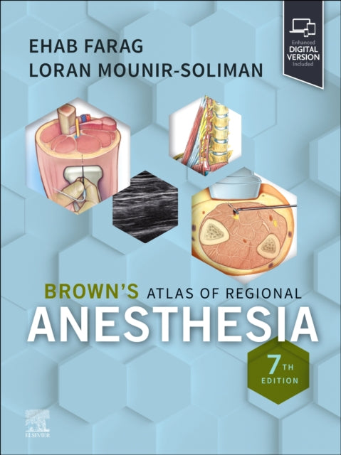 Browns Atlas of Regional Anesthesia