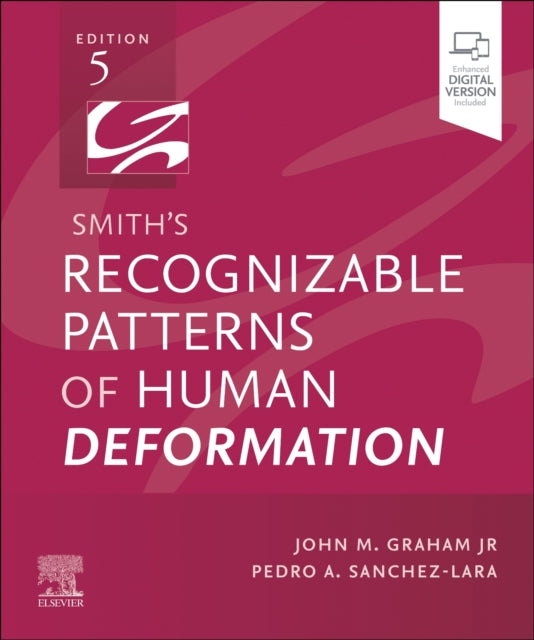 Smiths Recognizable Patterns of Human Deformation