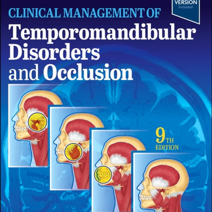 Clinical Management of Temporomandibular Disorders and Occlusion