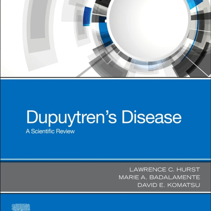 Dupuytrens Disease