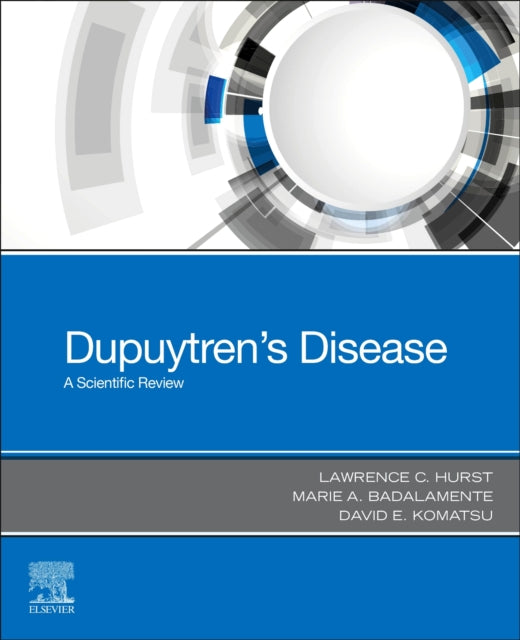 Dupuytrens Disease