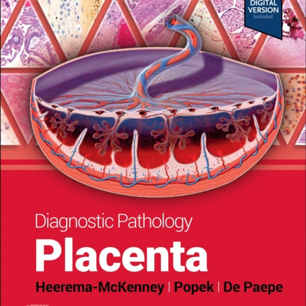 Diagnostic Pathology Placenta