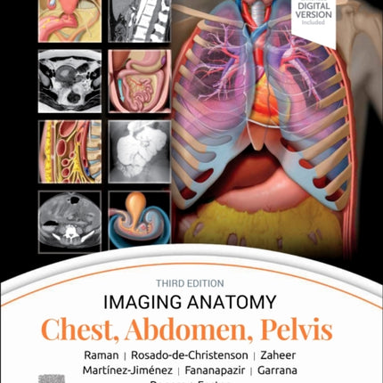 Imaging Anatomy: Chest, Abdomen, Pelvis