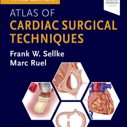Atlas of Cardiac Surgical Techniques