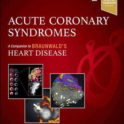 Acute Coronary Syndromes
