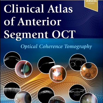 Clinical Atlas of Anterior Segment OCT Optical Coherence Tomography