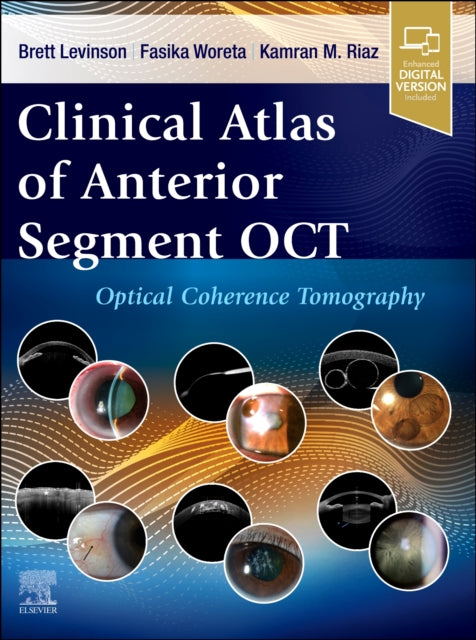 Clinical Atlas of Anterior Segment OCT Optical Coherence Tomography