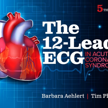 The 12Lead ECG in Acute Coronary Syndromes