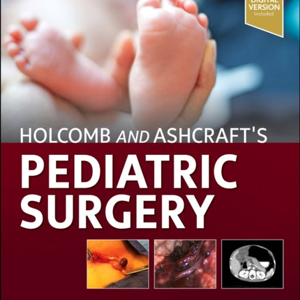 Holcomb and Ashcrafts Pediatric Surgery