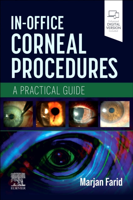 InOffice Corneal Procedures