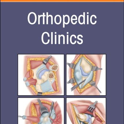 Infections An Issue of Orthopedic Clinics