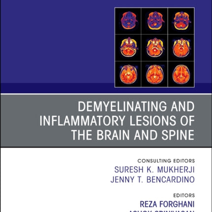 Demyelinating and Inflammatory Lesions of the Brain and Spine An Issue of Magnetic Resonance Imaging Clinics of North America