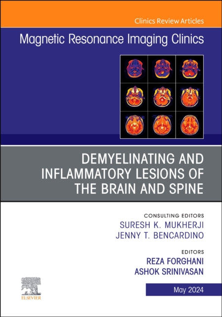 Demyelinating and Inflammatory Lesions of the Brain and Spine An Issue of Magnetic Resonance Imaging Clinics of North America