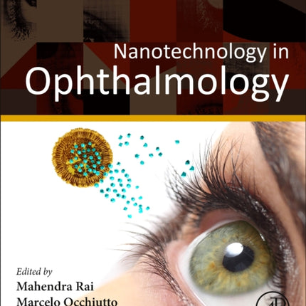 Nanotechnology in Ophthalmology