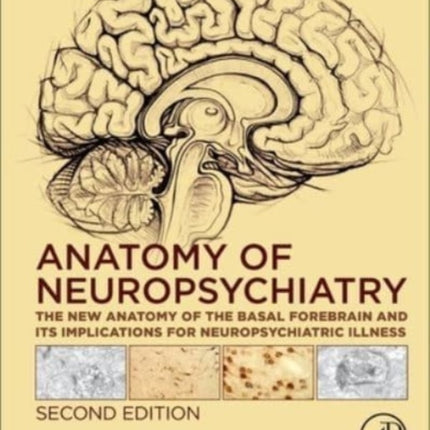 Anatomy of Neuropsychiatry: The New Anatomy of the Basal Forebrain and Its Implications for Neuropsychiatric Illness