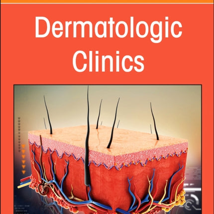 Neutrophilic Dermatoses An Issue of Dermatologic Clinics