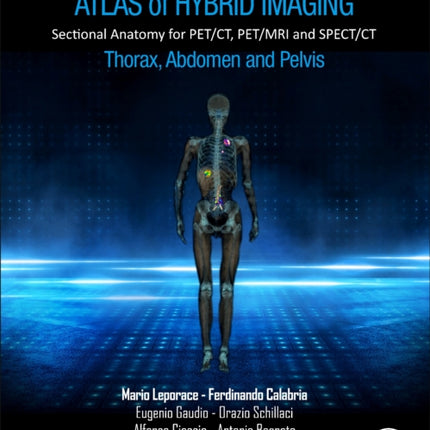 Atlas of Hybrid Imaging Sectional Anatomy for PET/CT, PET/MRI and SPECT/CT Vol. 2: Thorax Abdomen and Pelvis: Sectional Anatomy for PET/CT, PET/MRI and SPECT/CT