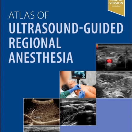 Atlas of UltrasoundGuided Regional Anesthesia