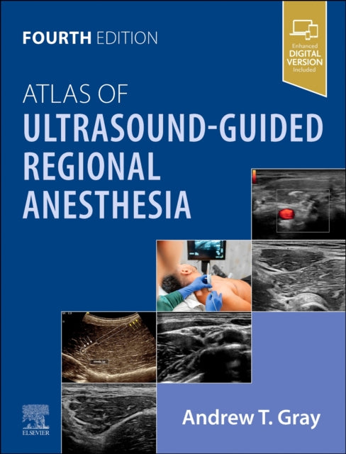 Atlas of UltrasoundGuided Regional Anesthesia