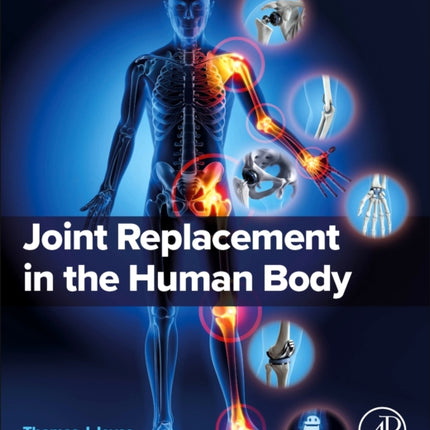 Joint Replacement in the Human Body